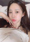 Endotine thread lifting, Epicanthoplasty, Nose revision surgery, lip tip lift — Korea cost, reviews & before-after | MISOODA