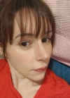 Rhinoplasty + Fat graft + PRP + Eye bag removal + Thread Lift + Lip Filler — Korea cost, reviews & before-after | MISOODA