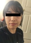 MISOODA — Korea cost, reviews & before-after | MISOODA