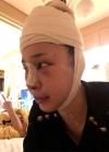 Endotine thread lifting, Epicanthoplasty, Nose revision surgery, lip tip lift — Korea cost, reviews & before-after | MISOODA