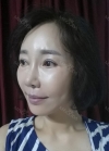 eye, nose, face lifting, fat grafting — Korea cost, reviews & before-after | MISOODA