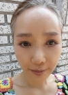 eye, nose, face lifting, fat grafting — Korea cost, reviews & before-after | MISOODA