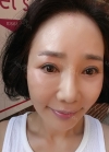 eye, nose, face lifting, fat grafting — Korea cost, reviews & before-after | MISOODA