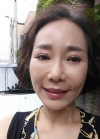eye, nose, face lifting, fat grafting — Korea cost, reviews & before-after | MISOODA