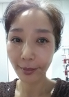 eye, nose, face lifting, fat grafting — Korea cost, reviews & before-after | MISOODA