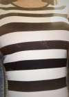 Br (m) Icom _ teardrop implants on both sides 315cc 162 / 56kg — Korea cost, reviews & before-after | MISOODA