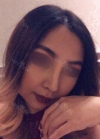 Eye, Nose, Facial contouring at View — Korea cost, reviews & before-after | MISOODA