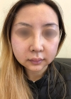 Eye, Nose, Facial contouring at View — Korea cost, reviews & before-after | MISOODA