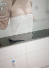 Br (m) Icom _ teardrop implants on both sides 315cc 162 / 56kg — Korea cost, reviews & before-after | MISOODA