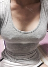 Br (m) Icom _ teardrop implants on both sides 315cc 162 / 56kg — Korea cost, reviews & before-after | MISOODA