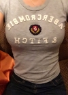 Br (m) Icom _ teardrop implants on both sides 315cc 162 / 56kg — Korea cost, reviews & before-after | MISOODA