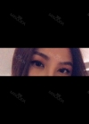 Eyes and Accuift surgery — Korea cost, reviews & before-after | MISOODA