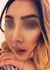 Eye, Nose, Facial contouring at View — Korea cost, reviews & before-after | MISOODA