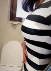 Br (m) Icom _ teardrop implants on both sides 315cc 162 / 56kg — Korea cost, reviews & before-after | MISOODA