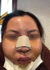 Eye, Nose, Facial contouring at View — Korea cost, reviews & before-after | MISOODA
