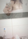 Br (m) Icom _ teardrop implants on both sides 315cc 162 / 56kg — Korea cost, reviews & before-after | MISOODA