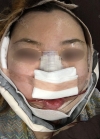 Eye, Nose, Facial contouring at View — Korea cost, reviews & before-after | MISOODA
