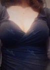 Br (m) Icom _ teardrop implants on both sides 315cc 162 / 56kg — Korea cost, reviews & before-after | MISOODA
