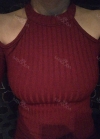 Br (m) Icom _ teardrop implants on both sides 315cc 162 / 56kg — Korea cost, reviews & before-after | MISOODA
