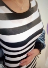 Br (m) Icom _ teardrop implants on both sides 315cc 162 / 56kg — Korea cost, reviews & before-after | MISOODA