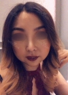 Eye, Nose, Facial contouring at View — Korea cost, reviews & before-after | MISOODA