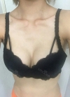 Br (T / underline) — Korea cost, reviews & before-after | MISOODA