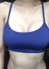 Br (T / underline) — Korea cost, reviews & before-after | MISOODA