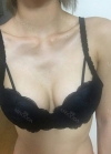 Br (T / underline) — Korea cost, reviews & before-after | MISOODA