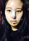 Genio (adv) + Rhino + B — Korea cost, reviews & before-after | MISOODA