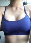 Br (T / underline) — Korea cost, reviews & before-after | MISOODA
