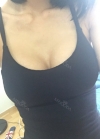 Br (T / underline) — Korea cost, reviews & before-after | MISOODA