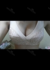 Motiva breast implants after 7 months with under breast incision (left 310cc, right 300cc) — Korea cost, reviews & before-after | MISOODA