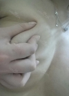 Motiva breast implants after 7 months with under breast incision (left 310cc, right 300cc) — Korea cost, reviews & before-after | MISOODA