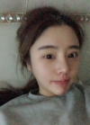 Double eyelid revision, Nose revision, Facial Liposuction, Face Fat Grafting — Korea cost, reviews & before-after | MISOODA