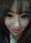 Double eyelid revision, Nose revision, Facial Liposuction, Face Fat Grafting — Korea cost, reviews & before-after | MISOODA