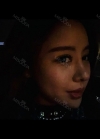 Double eyelid revision, Nose revision, Facial Liposuction, Face Fat Grafting — Korea cost, reviews & before-after | MISOODA