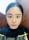 Double eyelid revision, Nose revision, Facial Liposuction, Face Fat Grafting — Korea cost, reviews & before-after | MISOODA