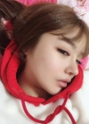 Double eyelid revision, Nose revision, Facial Liposuction, Face Fat Grafting — Korea cost, reviews & before-after | MISOODA