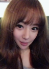 Double eyelid revision, Nose revision, Facial Liposuction, Face Fat Grafting — Korea cost, reviews & before-after | MISOODA