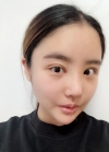 Double eyelid revision, Nose revision, Facial Liposuction, Face Fat Grafting — Korea cost, reviews & before-after | MISOODA