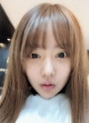Double eyelid revision, Nose revision, Facial Liposuction, Face Fat Grafting — Korea cost, reviews & before-after | MISOODA