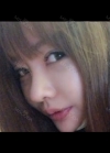 Double eyelid revision, Nose revision, Facial Liposuction, Face Fat Grafting — Korea cost, reviews & before-after | MISOODA