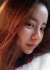 Double eyelid revision, Nose revision, Facial Liposuction, Face Fat Grafting — Korea cost, reviews & before-after | MISOODA