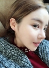 Double eyelid revision, Nose revision, Facial Liposuction, Face Fat Grafting — Korea cost, reviews & before-after | MISOODA