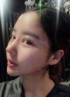 Double eyelid revision, Nose revision, Facial Liposuction, Face Fat Grafting — Korea cost, reviews & before-after | MISOODA