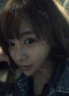 Double eyelid revision, Nose revision, Facial Liposuction, Face Fat Grafting — Korea cost, reviews & before-after | MISOODA