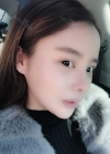 Double eyelid revision, Nose revision, Facial Liposuction, Face Fat Grafting — Korea cost, reviews & before-after | MISOODA