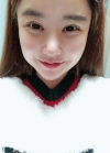 Double eyelid revision, Nose revision, Facial Liposuction, Face Fat Grafting — Korea cost, reviews & before-after | MISOODA