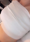 Fourteen Months of Breast Re-surgery — Korea cost, reviews & before-after | MISOODA