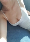 Fourteen Months of Breast Re-surgery — Korea cost, reviews & before-after | MISOODA